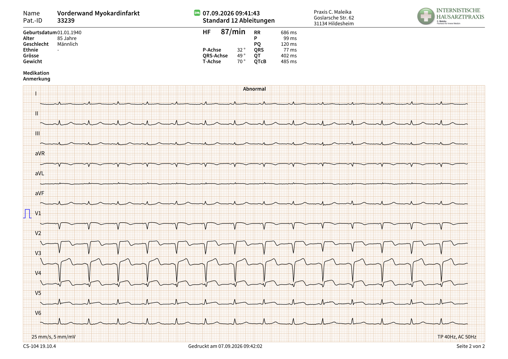 Vorderwandinfarkt